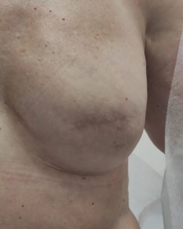 Curso Micropigmentación Oncológica - Imagen 15