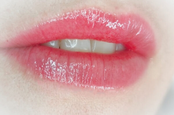 Micropigmentación Labios - Imagen 5