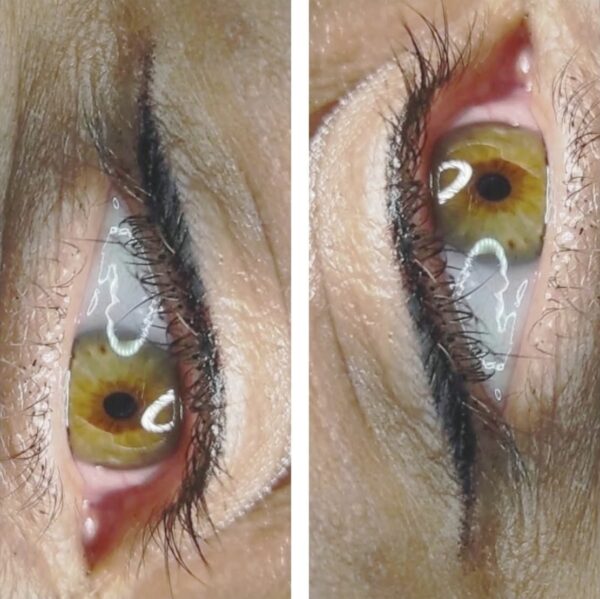 Micropigmentación Eye Liner - Imagen 8